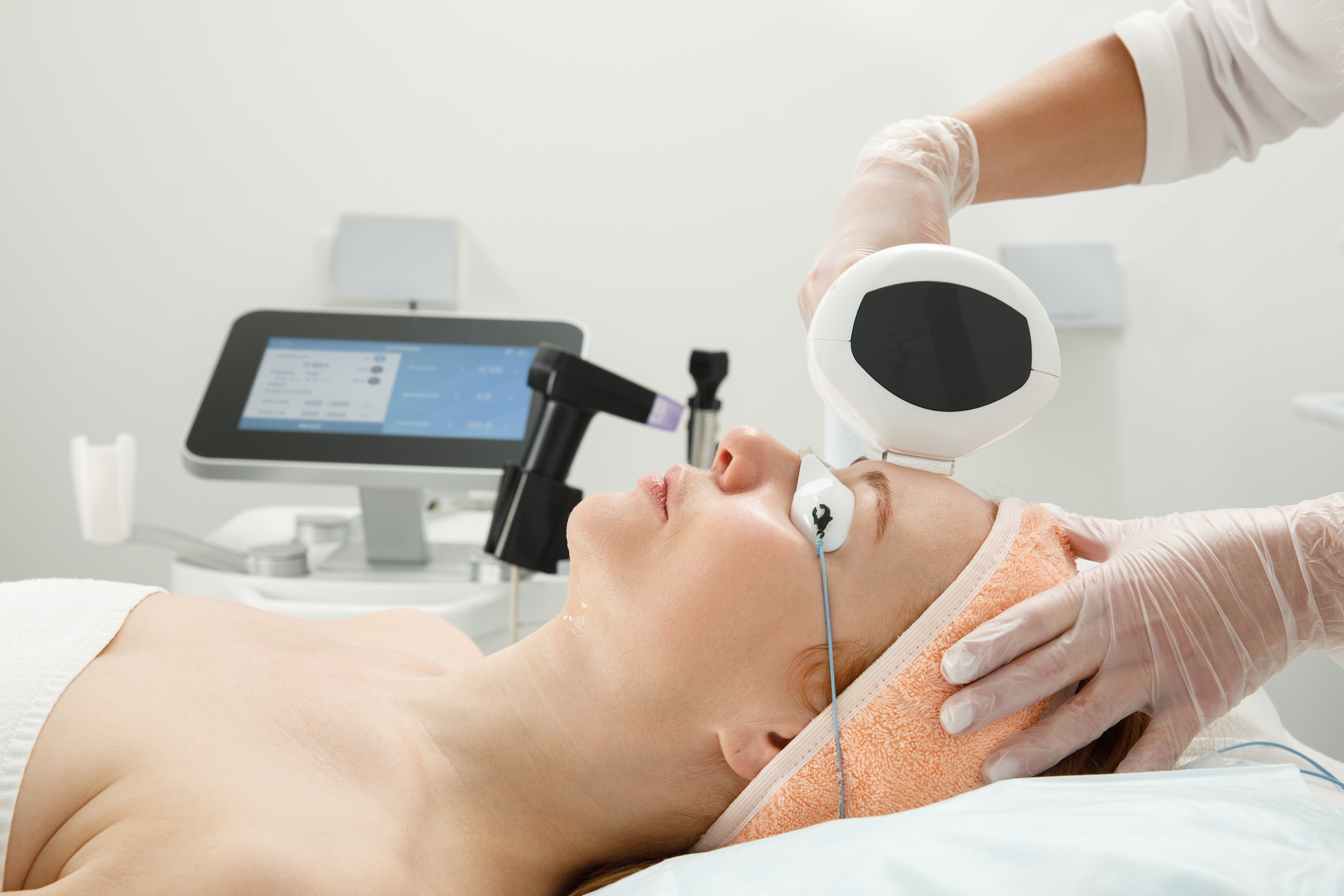 why-laser-treatments-are-the-solution-for-acne